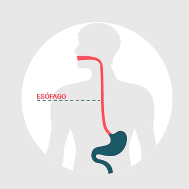 Ensayo clínico para pacientes con cáncer de esófago metastásico de células escamosas 