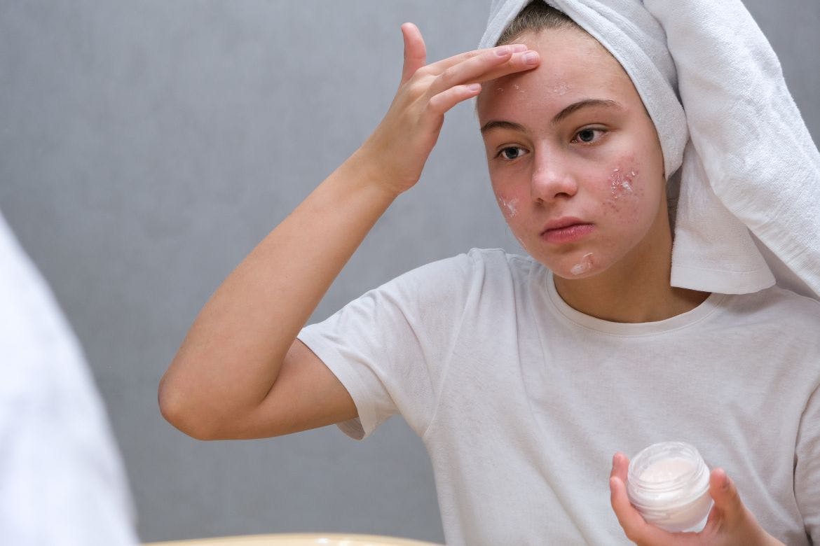 Dermatitis atópica: 10 tips para cuidar la piel