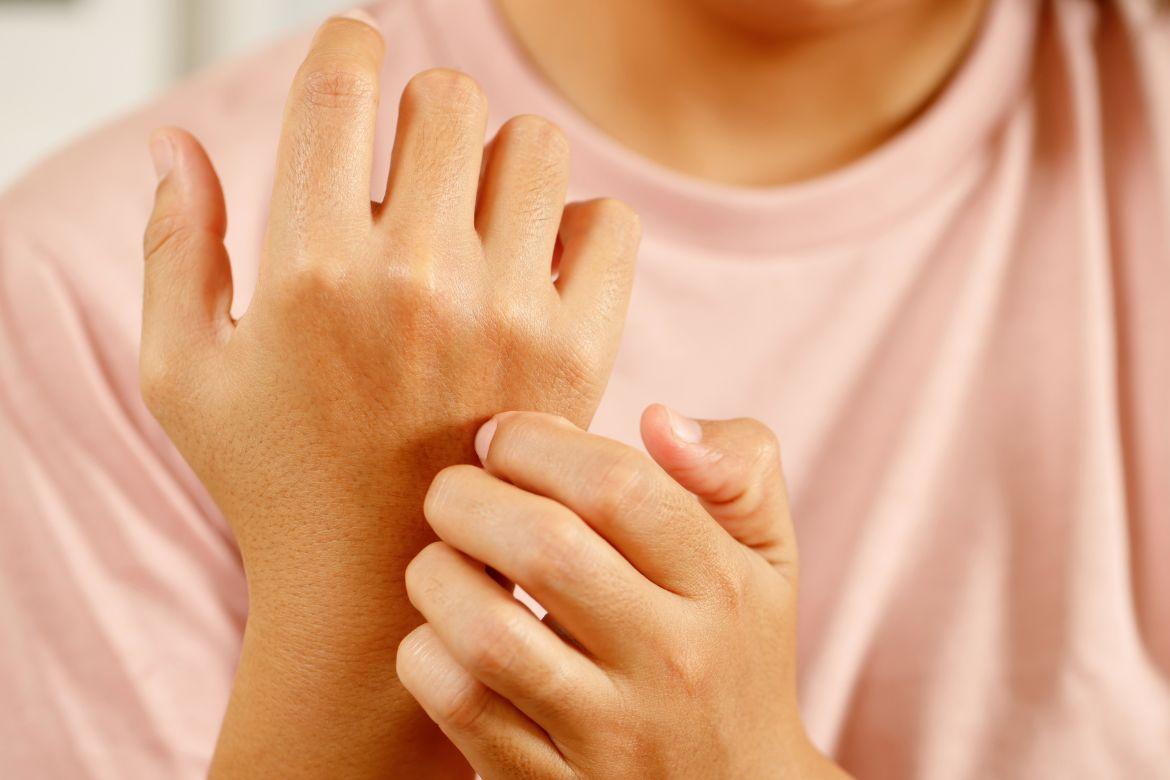 Dermatitis atópica en niños y adolescentes: tratamiento en investigación