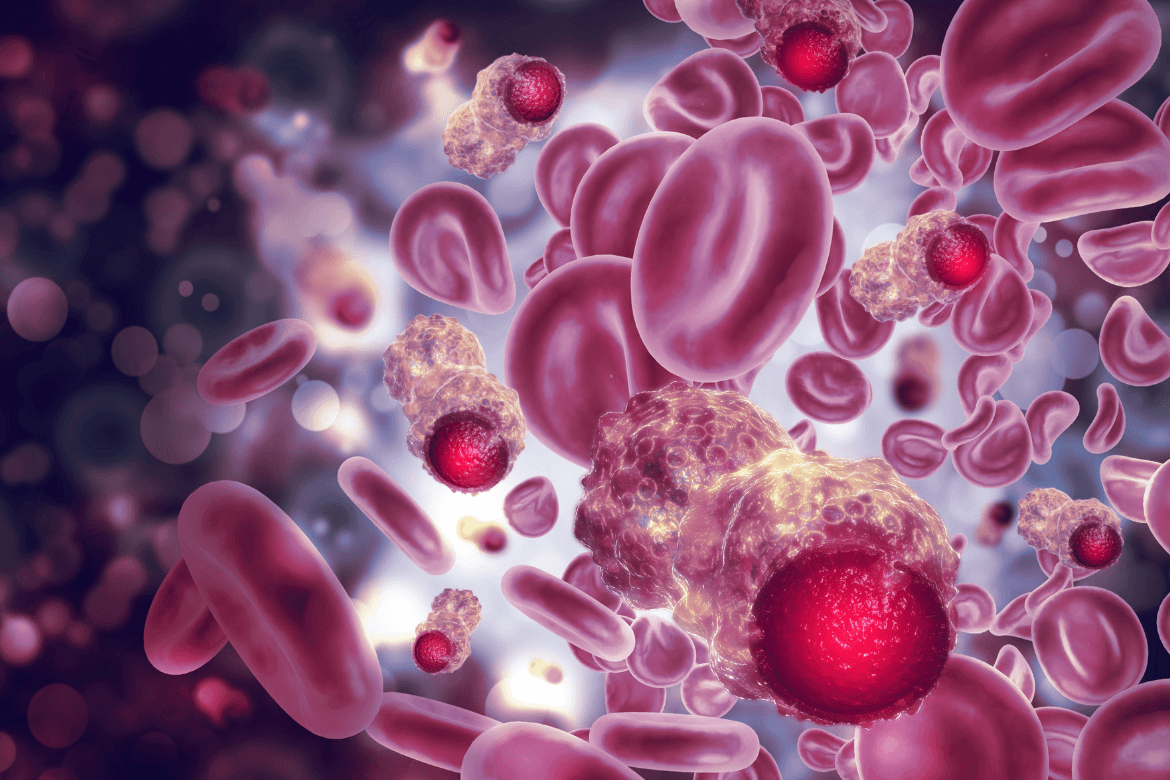 Avance en el tratamiento para la Leucemia Mieloide Crónica