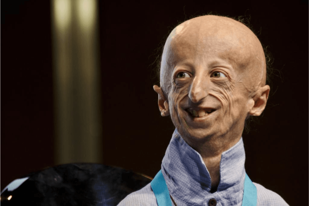 ¿Sabías que el personaje de Benjamin Button existió en la vida real?