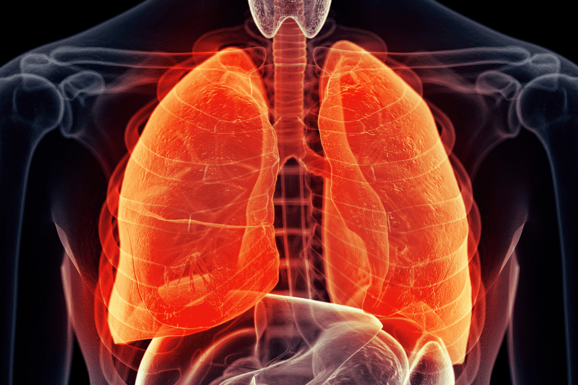 El desafío de la fibrosis pulmonar