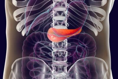 Cáncer de páncreas: logran eliminar tumores en modelos animales