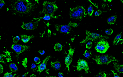 ELA: ciencia española impulsa un nuevo tratamiento hacia fase clínica