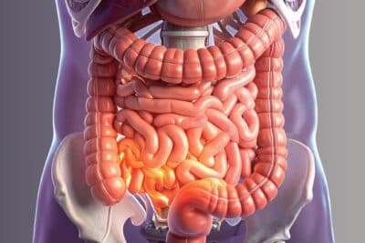 Estudo clínico avalia tratamento para doença de Crohn ativa de moderada a severa