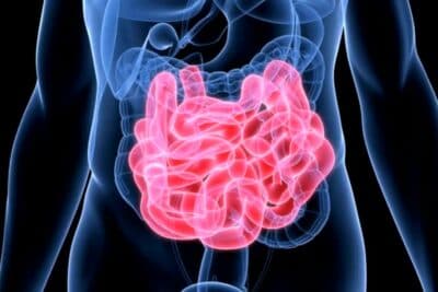 Diferencias entre enfermedad de Crohn y colitis ulcerosa: síntomas, causas y tratamiento